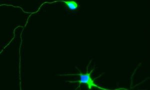 Rat cortical neurons labeled with an antibody that recognizes beta-III tubulin, a protein found in microtubules (green) and Hoechst dye labels all cell nuclei (blue).